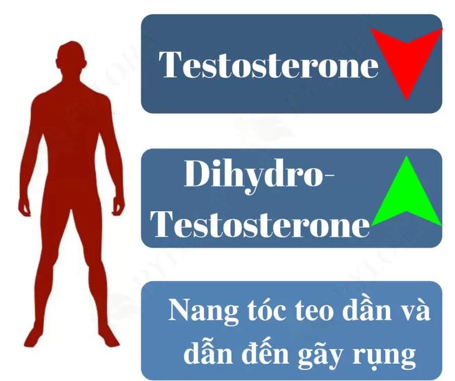 Khi Dihydro Testo tăng lên khiến nang tóc bị teo lại nên rụng tóc nhiều