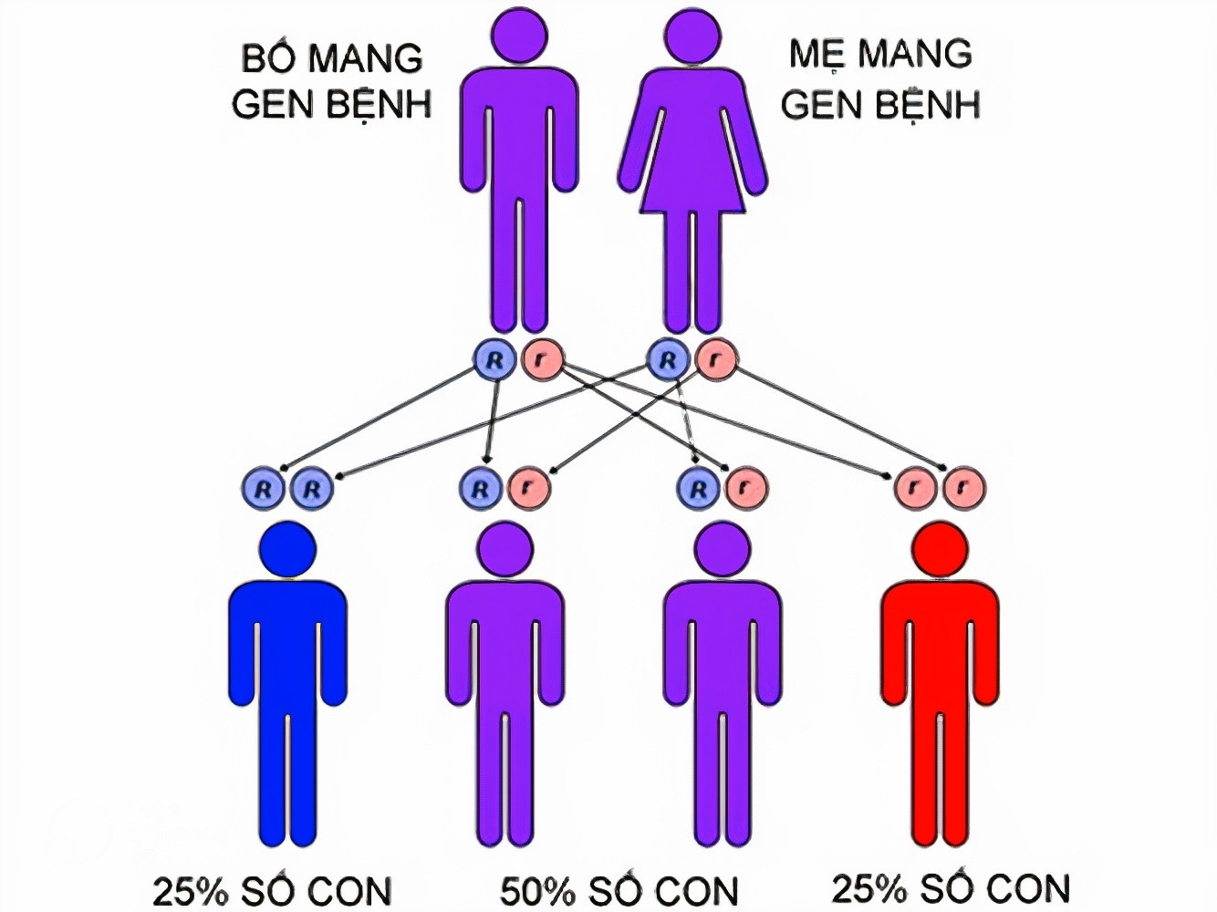 Hói đầu là bệnh lý thuộc vào gen trội nên khả năng di truyền rất cao