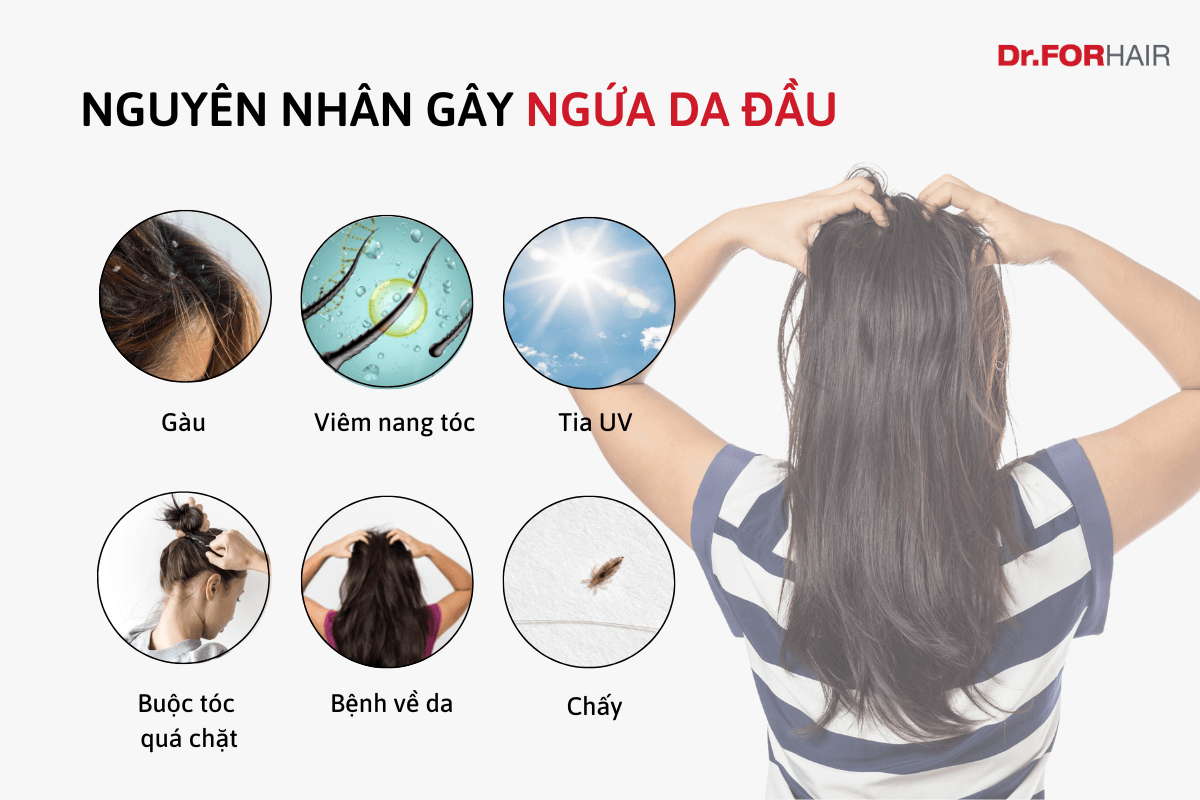 Nguyên Nhân Gây Ngứa Da Đầu